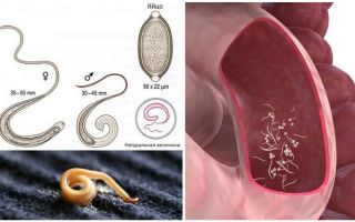 Wie man Pinworms bei Erwachsenen und Kindern entfernt