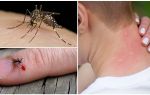 Was ist, wenn eine Mücke beißt?