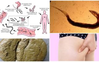 Wie die Madenwürmer im Kot aussehen