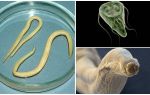 Vergleich von Giardia und Würmern